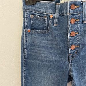 Madewell 10 in High Rise Skinny button fly
